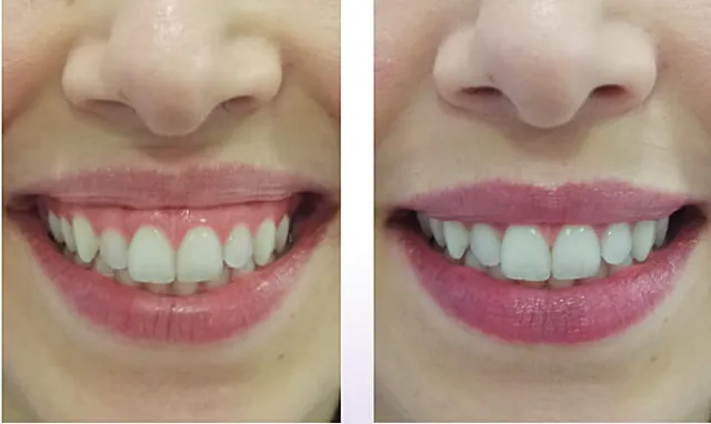 Resultado de Carolina Monteiro