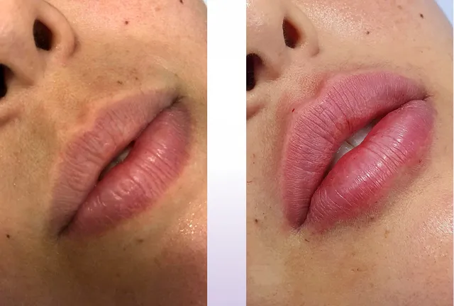 Resultado de Beatriz Rezende
